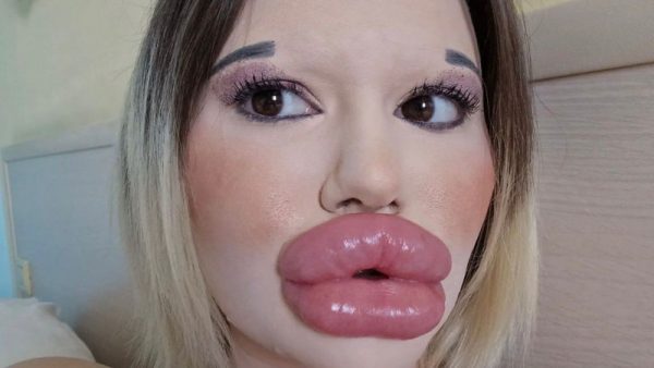 Девушка с самыми большими губами в мире хочет установить новый рекорд
