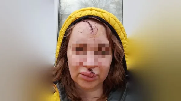 “Выбил зубы, изуродовал лицо“. Свидетельницу по уголовному делу жестоко избили в Петропавловске